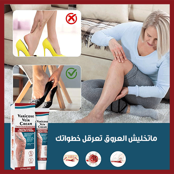 كريم الدوالي - Cream Varicose Veins