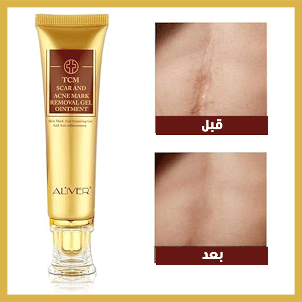 كريم المعجزه لعلاج الندبات - TCM™ scar and acne mark removal gel