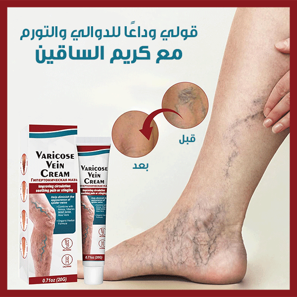 كريم الدوالي - Cream Varicose Veins